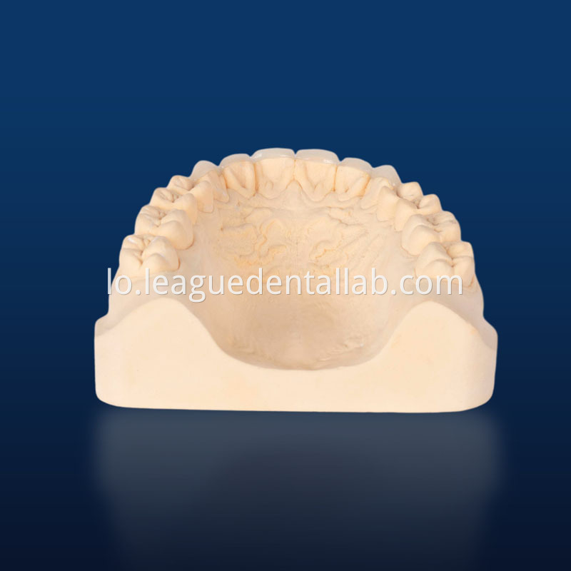 Ips Empress, Emax Onlay, Emax Onlay, Emax Veneer, lithium dedilicate IPS Empress,Emax Onlay,Emax onlay,Emax Veneer,Lithium disilicate